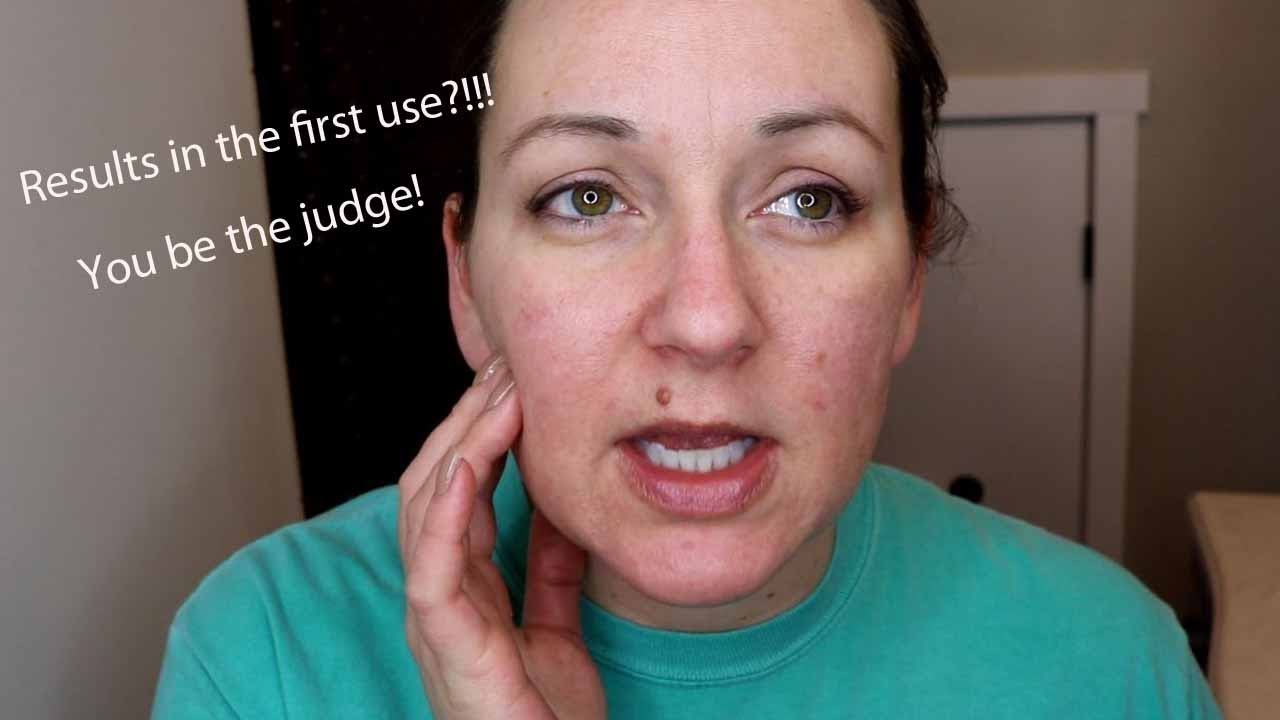 Clarins Extra-Firming Phyto and Eye Serum - First Impressions: Before and After