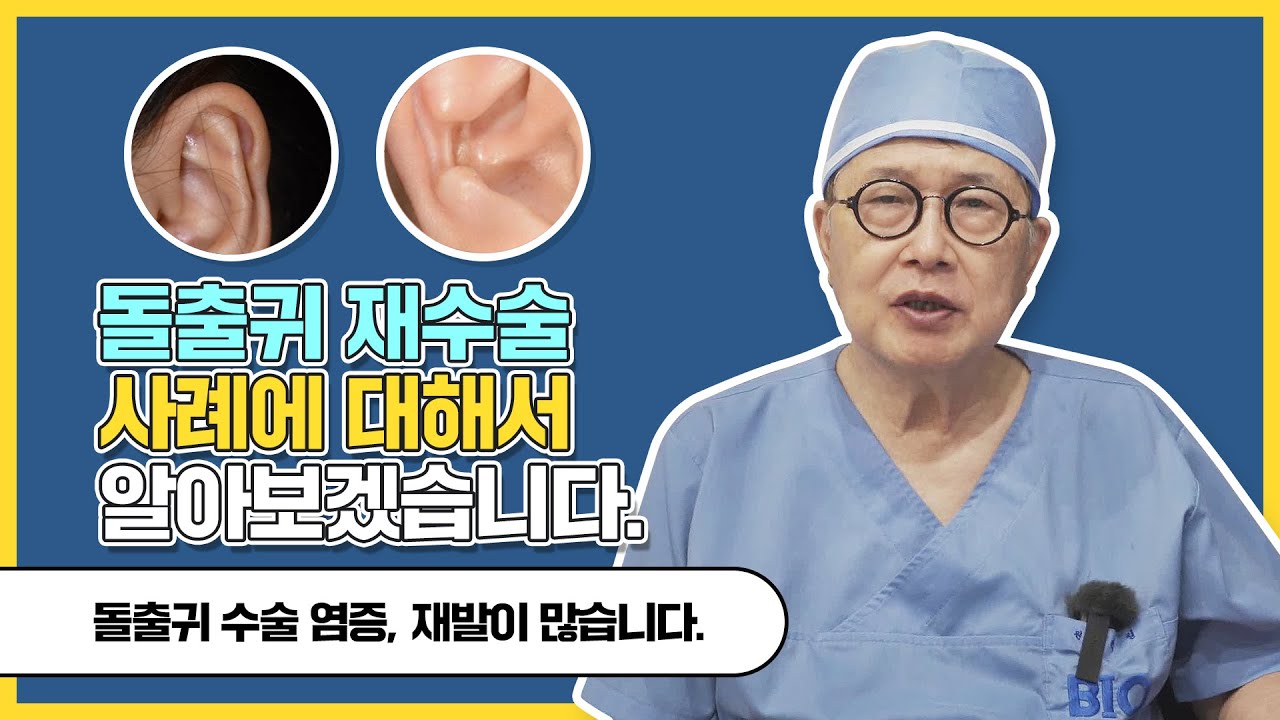 박철원장의 돌출귀재수술 사례를 보여드리겠습니다.