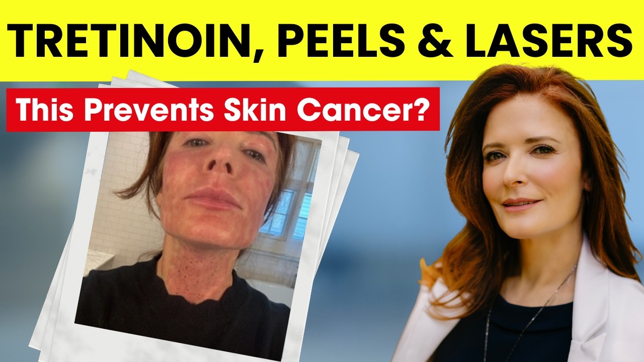 Tretinoin, Peels & Lasers: Skin Cancer Prevention You Did Not Expect with Dr. Dara Spearman