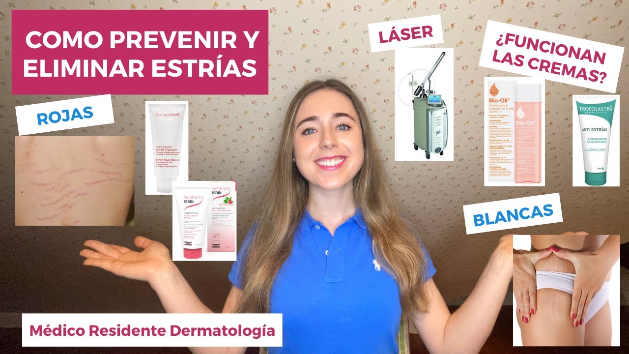 CÓMO PREVENIR Y ELIMINAR LAS ESTRÍAS BLANCAS Y ROJAS | BIO-OIL, ACEITE, LÁSER | ¿FUNCIONAN? EMBARAZO