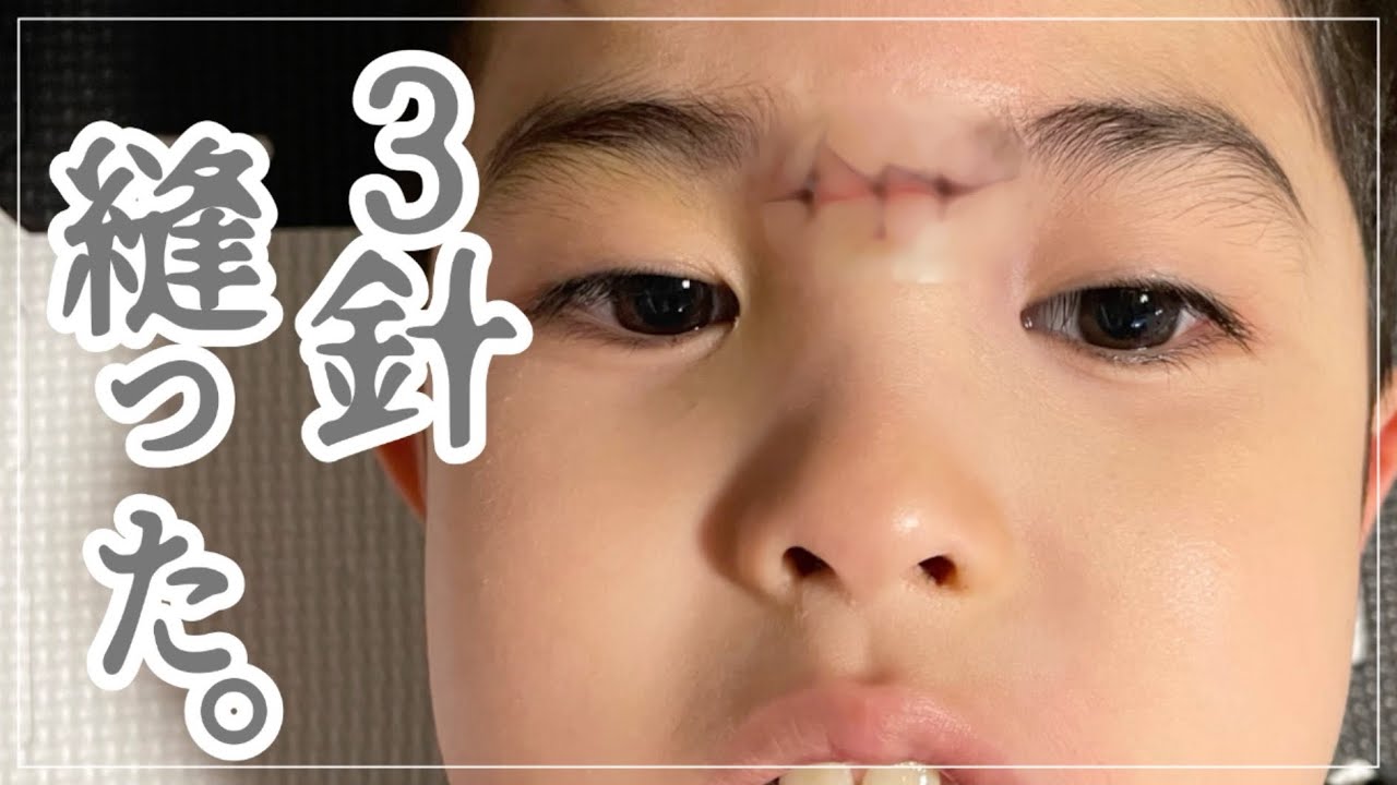 【もう限界】１秒でも目離したら死にます。てんかん/異食/睡眠障害/施設入所？転校？