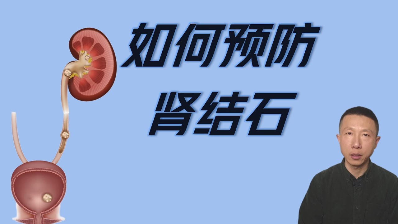 如何预防肾结石以及治疗肾结石