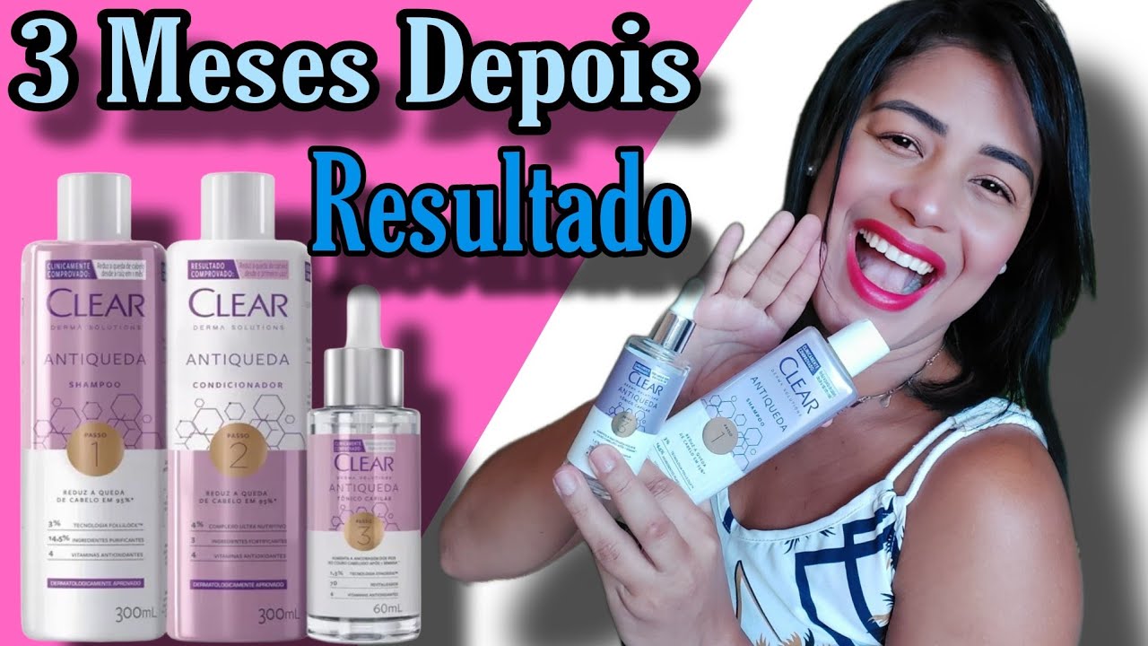 3 Meses Depois Com Antiqueda Clear Derma Solution
