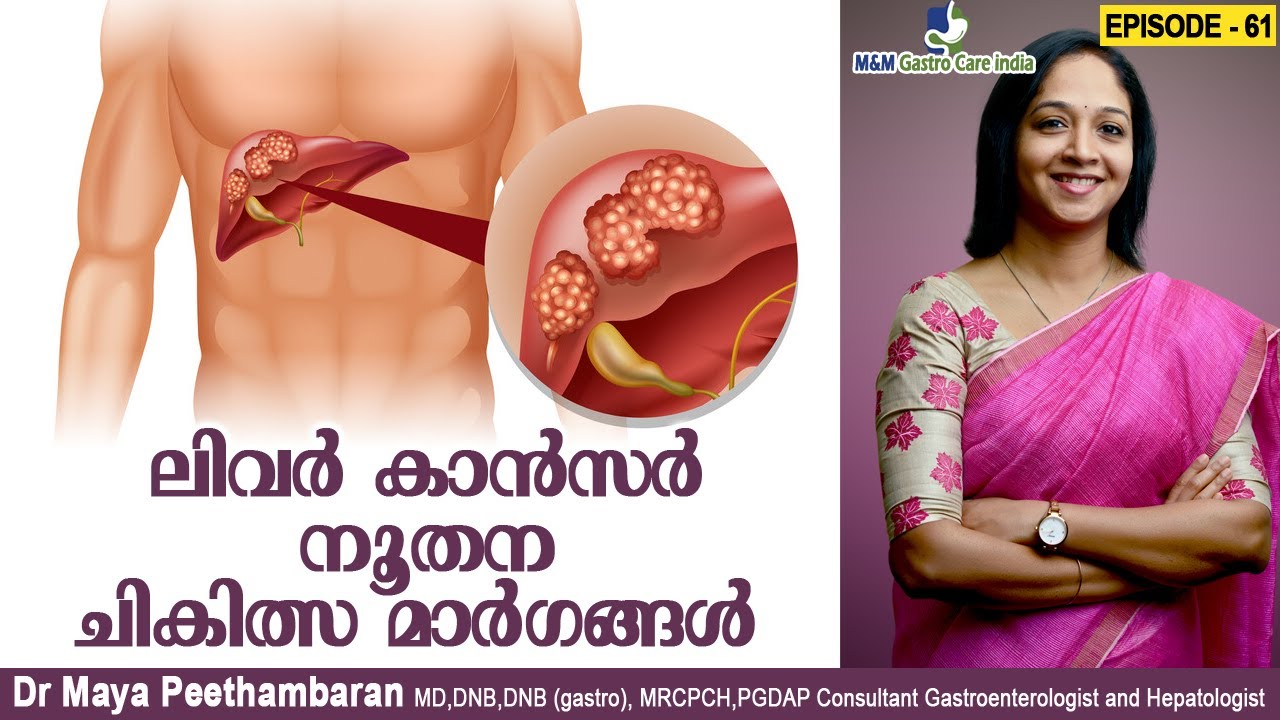 ലിവർ കാൻസർ - നൂതന ചികിത്സ മാർഗങ്ങൾ | Liver cancer | M&M Gastro Care India