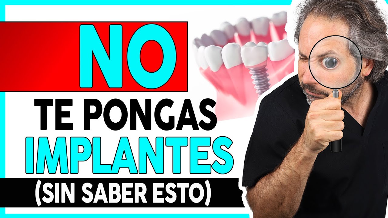 👉¿Que 𝗗𝗘𝗕𝗢 𝗦𝗔𝗕𝗘𝗥 del proceso de colocación de 𝗜𝗠𝗣𝗟𝗔𝗡𝗧𝗘𝗦 𝗗𝗘𝗡𝗧𝗔𝗟𝗘𝗦 para elegir a el DENTISTA ADECUADO?