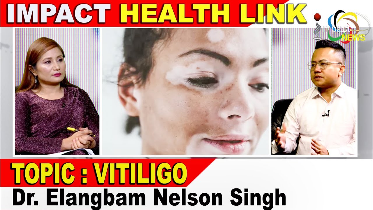 VITILIGO on IMPACT HEALTH LINK 25 JUNE 2022