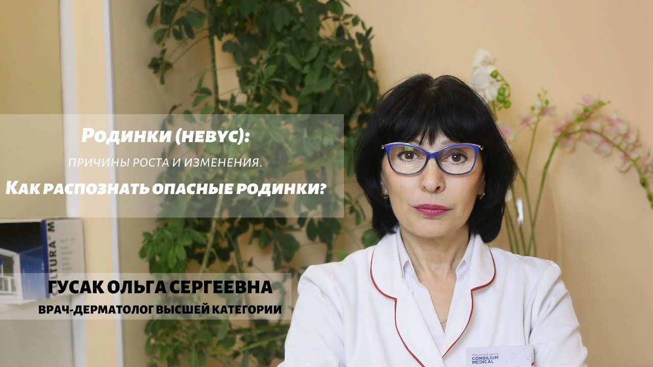 Родинки (невус): причины роста и изменения. Какие родинки опасны? Дерматоскопия