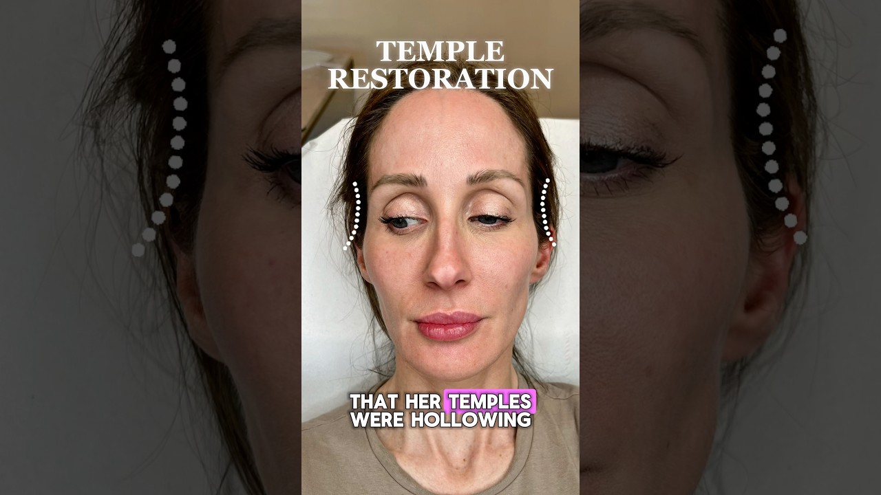 Temple Filler: The Underrated Game-Changer ✨