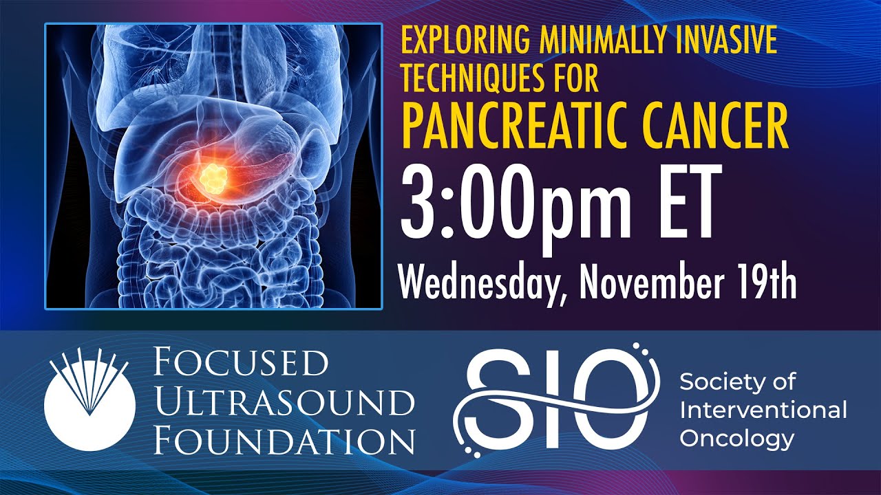Webinar: Exploring Minimally Invasive Techniques for Pancreatic Cancer