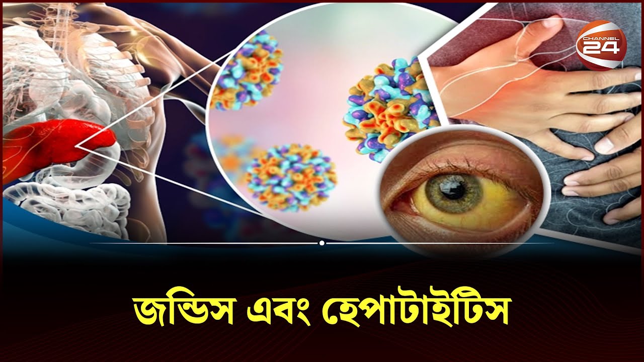 জন্ডিস হেপাটাইটিস কি এক জিনিস  | jaundice | Channel 24