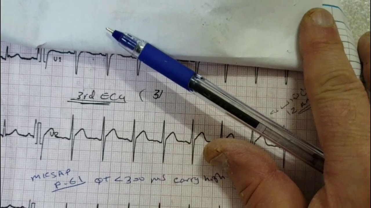 Short QT Interval in a Young Pt - By Prof.Saleh Al-Awdhaly