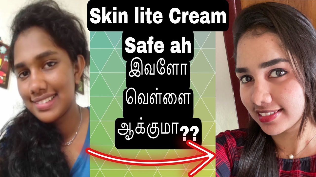 Skin lite cream proper usage to get results | skin lite cream review #skinwhitening