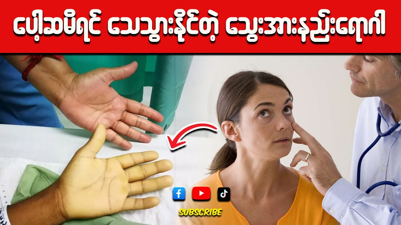 သတိမထားမိပဲ ပေါ့ဆရင် အသက်ဆုံးရှုံးသွားနိုင်တဲ့ သွေးအားနည်း ရောဂါ (သွေးအားနည်းရောဂါ လက္ခဏာများ)