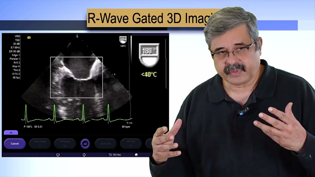 Three-Dimensional Echocardiography - Basic Understanding of R-Wave Gated  3D Echocardiography