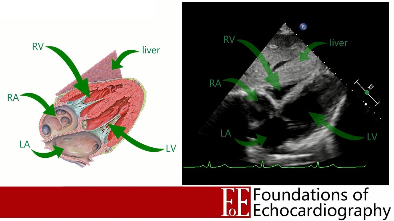 Level 1 Video Lecture: The Focused Echo