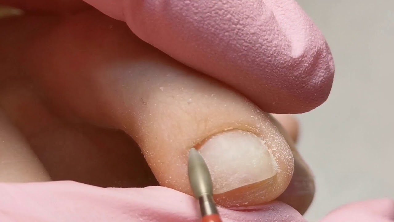 Pedicure kombinowany z użyciem removera.Pedicure sama sobie😳🤦‍♀️. Malowanie hybrydą.