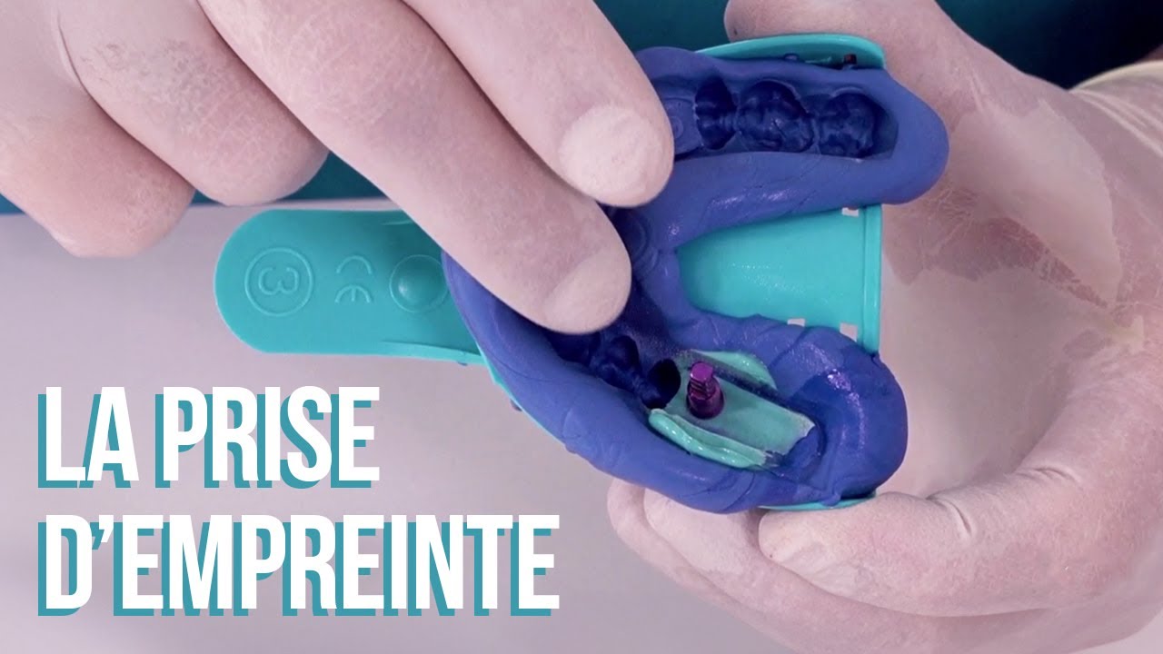 🦷 Tuto implanto #1 : La prise d'empreinte
