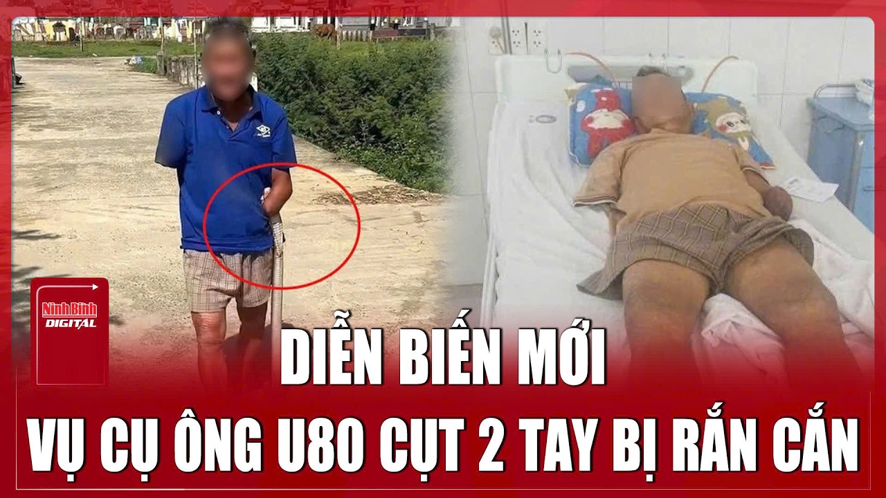Cụ ông U80 cụt 2 tay bị rắn hổ mang cắn ở Đà Nẵng: Gia đình xin dừng nhận hỗ trợ