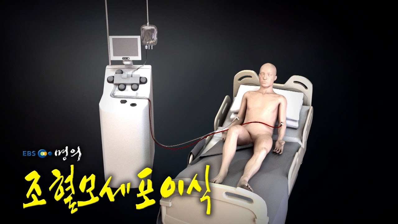 [명의 의학백과📖] 조혈모세포이식
