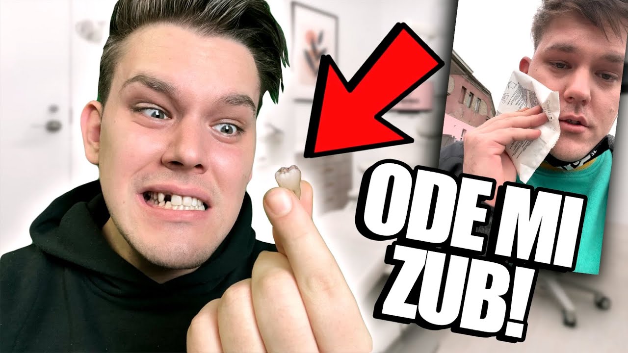 ODE MI ZUB... OPET!