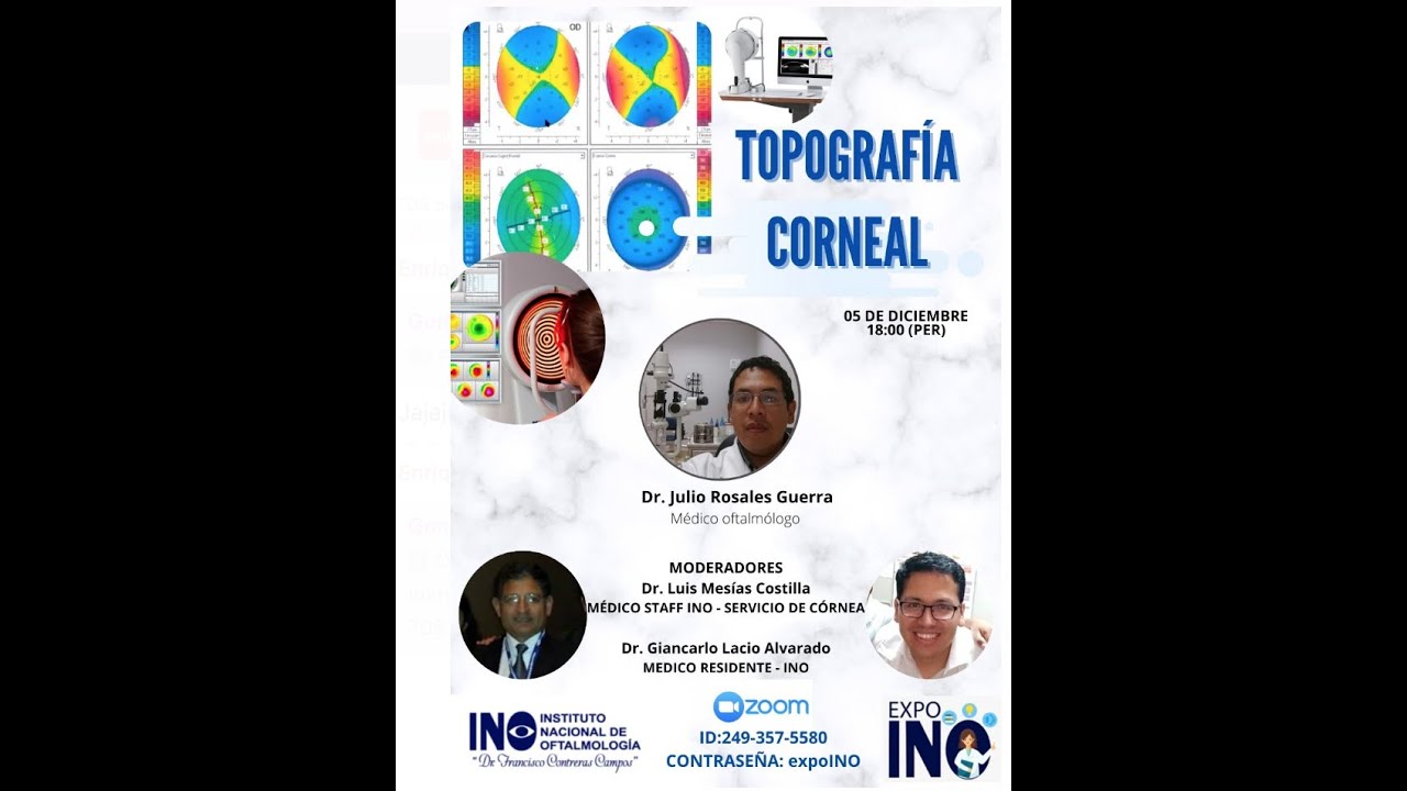 Topografia corneal. Dr J Rosales. Dr G Lacio Dr L Mesias