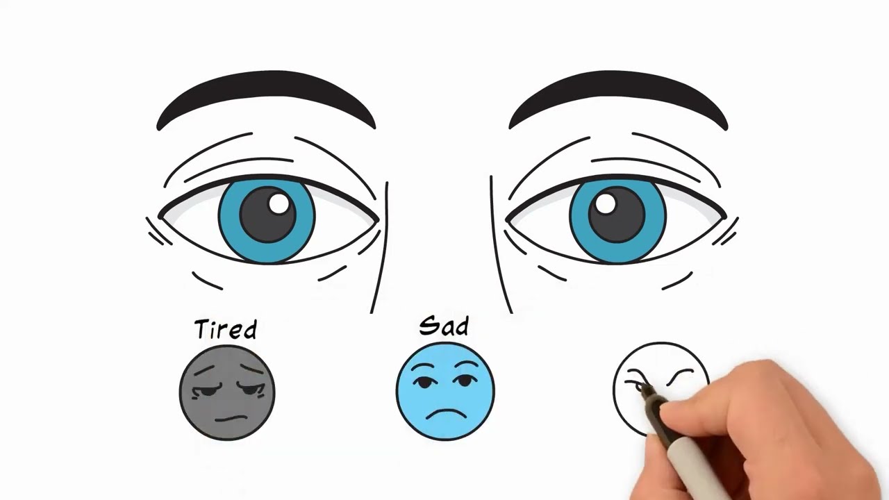 Upper Blepharoplasty Explained by Dr. Baccaro