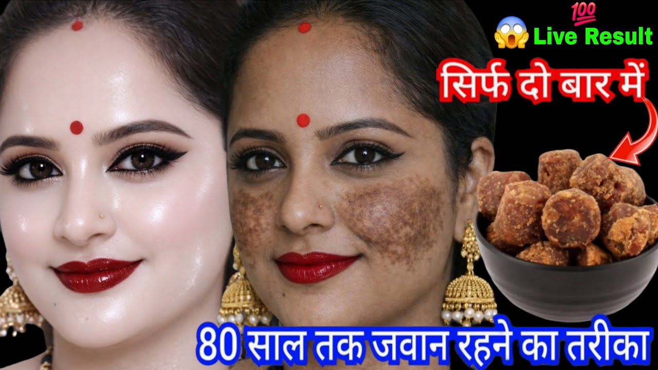 दो बूंद लगते ही मेरा चेहरा शीशे की तरह चमकने लगा👉10 साल पुरानी झाइयां काले दाग धब्बे सब साफ हो गए🙈