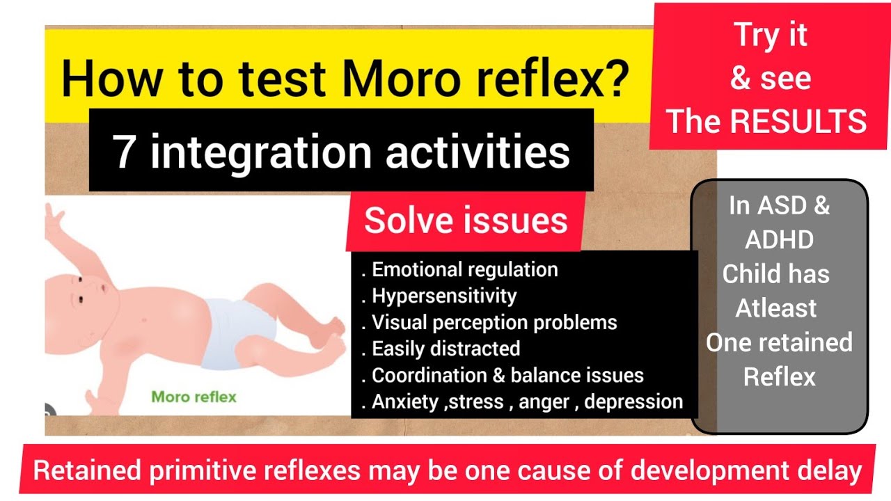 Moro reflex/issues if retained/How to test Moro reflex & 7 integration activities/primitive reflex