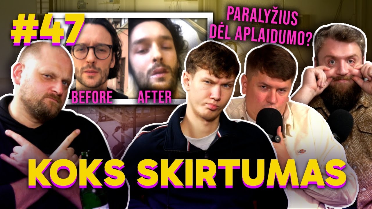 Paralyžius dėl medikų aplaidumo ir bernvakariai: KOKS SKIRTUMAS 47