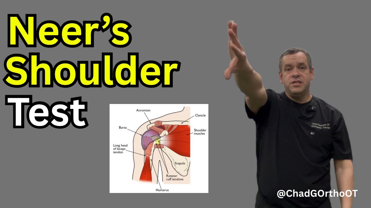 Neer’s Impingement Test Explained | Shoulder Special Test for Impingement