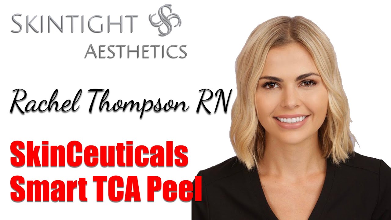 What is the SkinCeuticals Smart TCA Peel? And what does it do?
