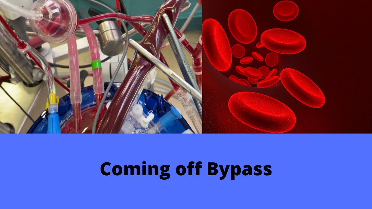 Coming off bypass