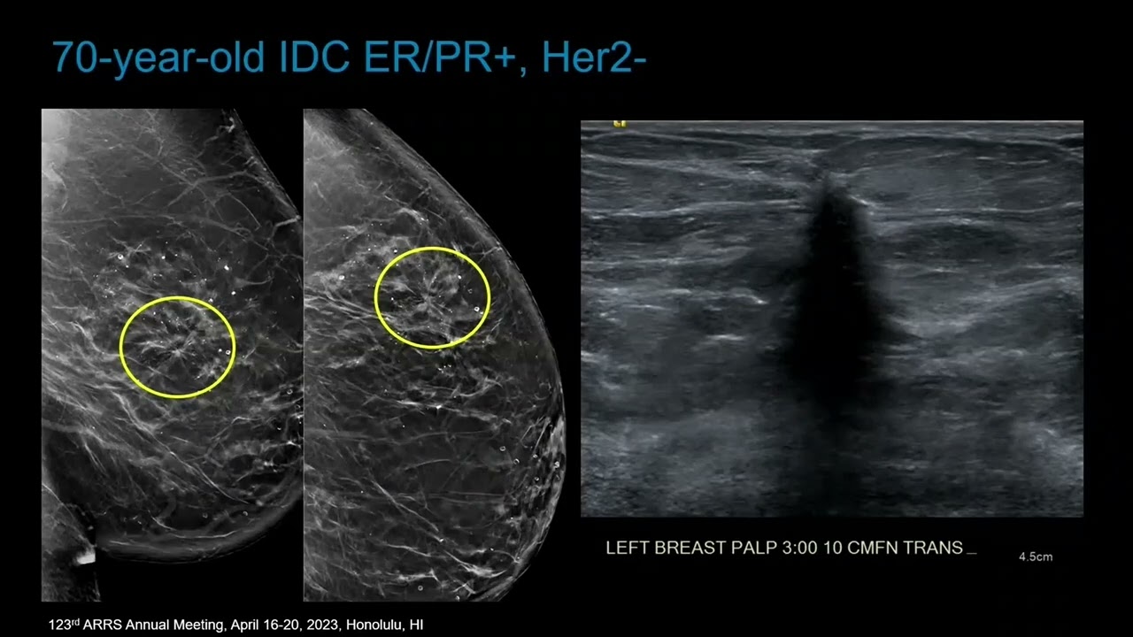 Case Review of Breast Imaging - Course Sample