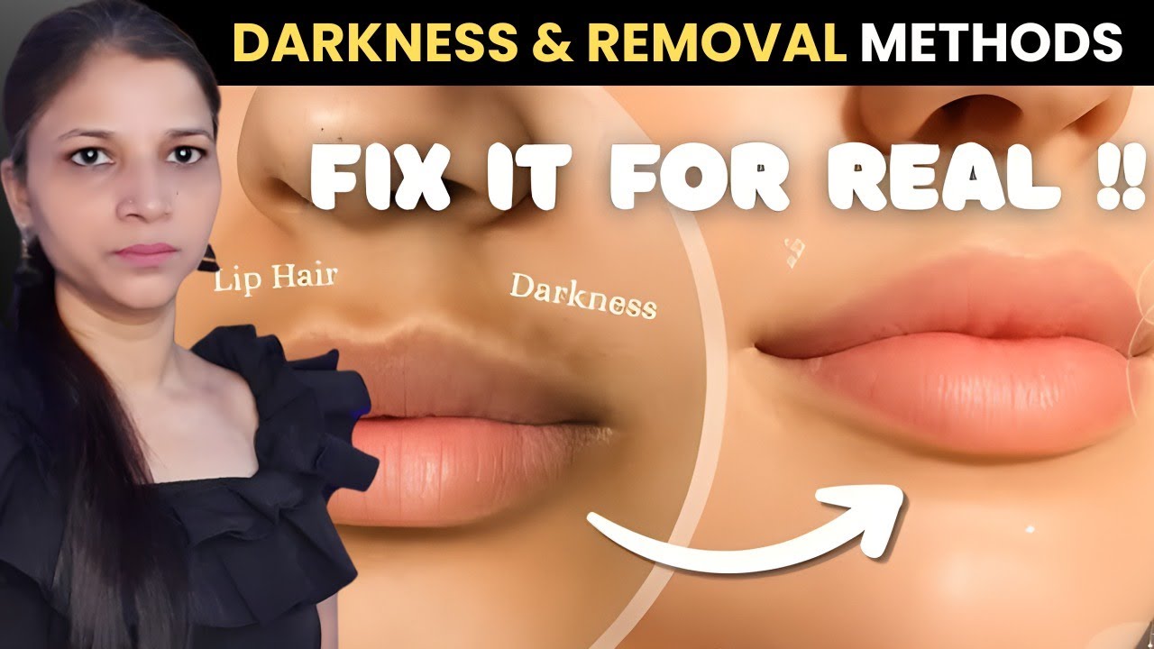 🍒 How to Get Rid of DARKNESS Around the Mouth + Upper Lip Hair Removal Methods 🌸 || By preetibella
