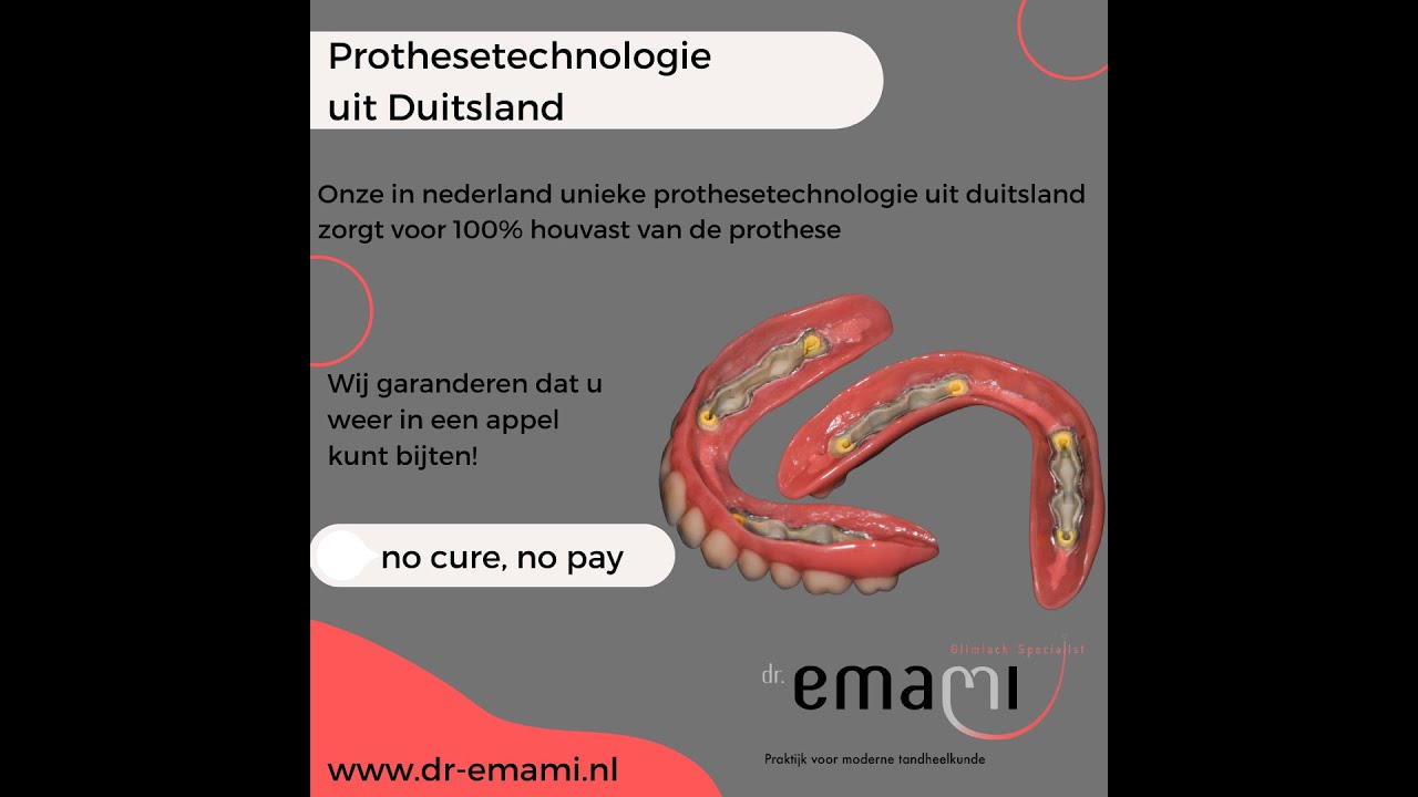 Gehemelte vrije prothese / kunstgebit zonder gehemelte