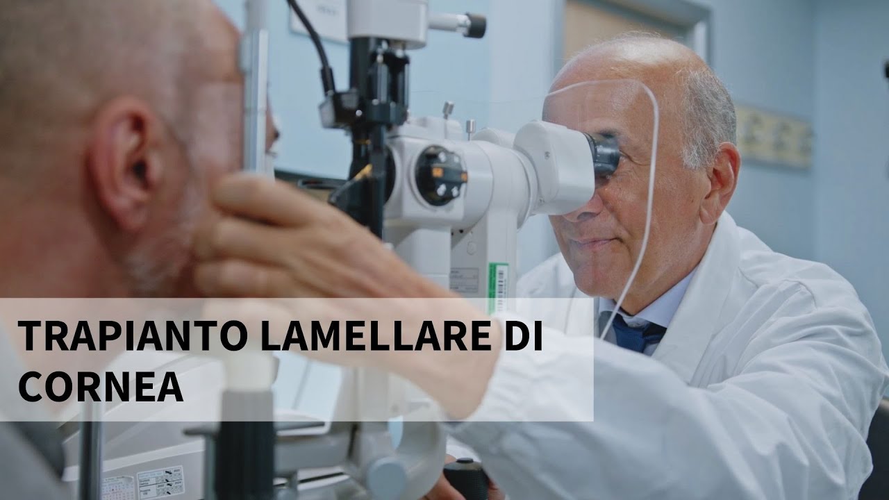 Il trapianto lamellare di cornea - Parliamo con il Prof. Luigi Fontana