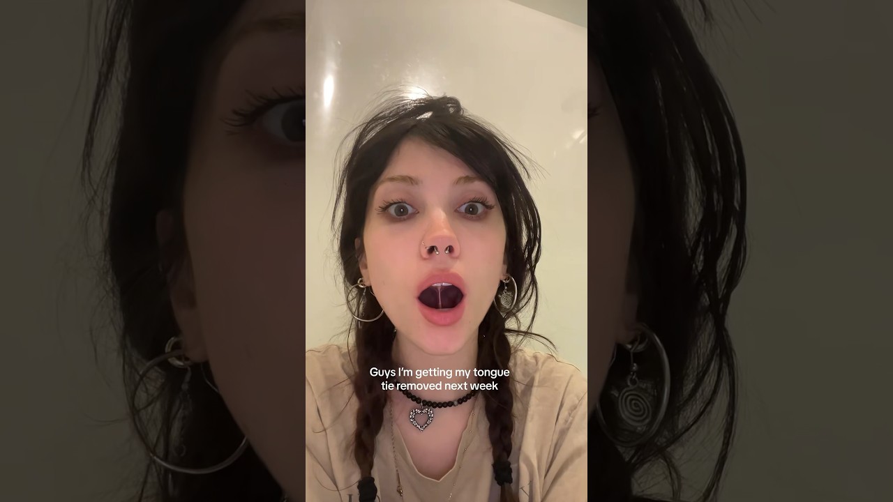 She Is Getting Her Tongue REMOVED!? 😳👅