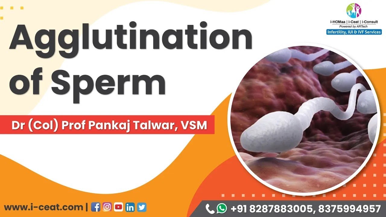 Sample with gross agglutination of sperm | i-Ceat - Clinical & Embryology Academy of ART