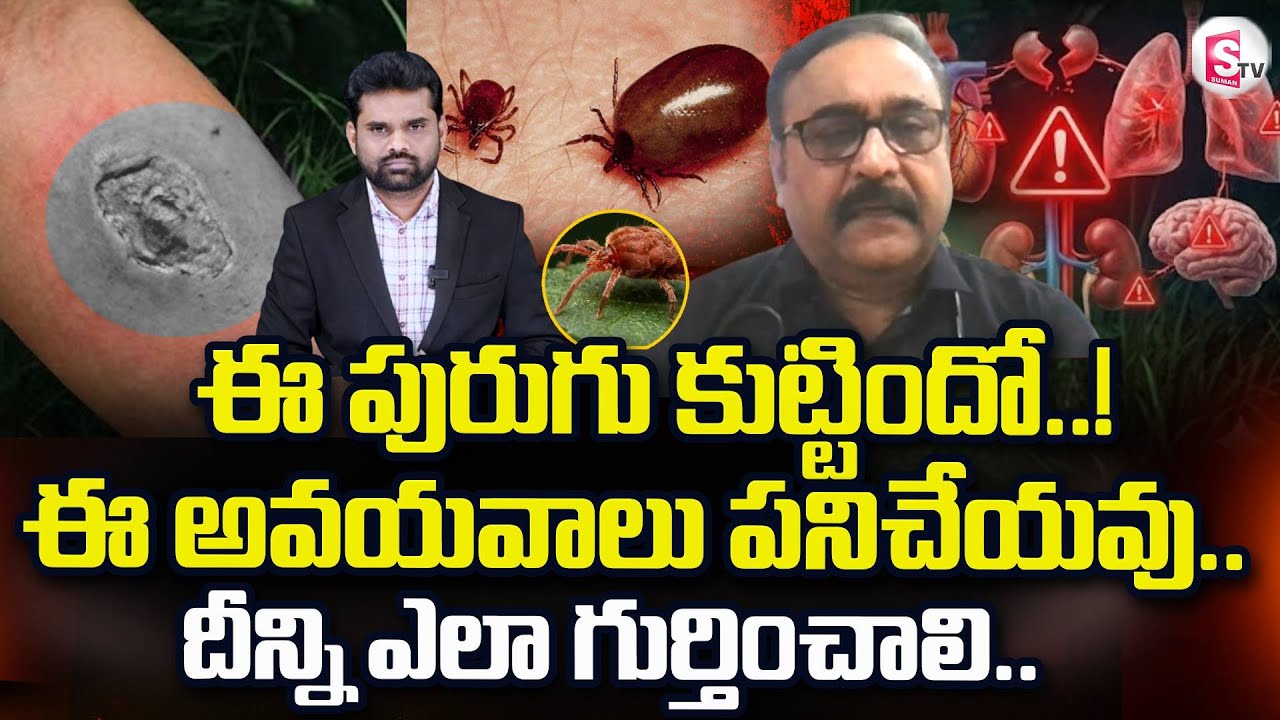 Scrub Typhus Latest News | Dr.Paparao About Scrub Typhus in AP | ఈ పురుగుతో జాగ్రత్త..| SumanTV Vali
