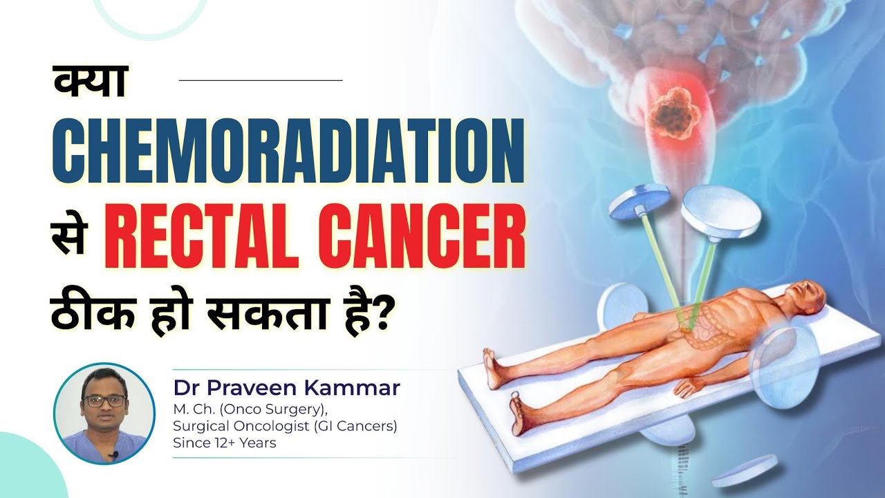 क्या Chemoradiation से Rectal Cancer ठीक हो सकता है? | Rectal Cancer & Chemoradiation! | Dr Praveen
