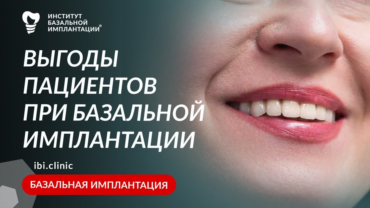 Выгоды при базальной имплантации: что получает пациент после лечения и восстановления зубов?