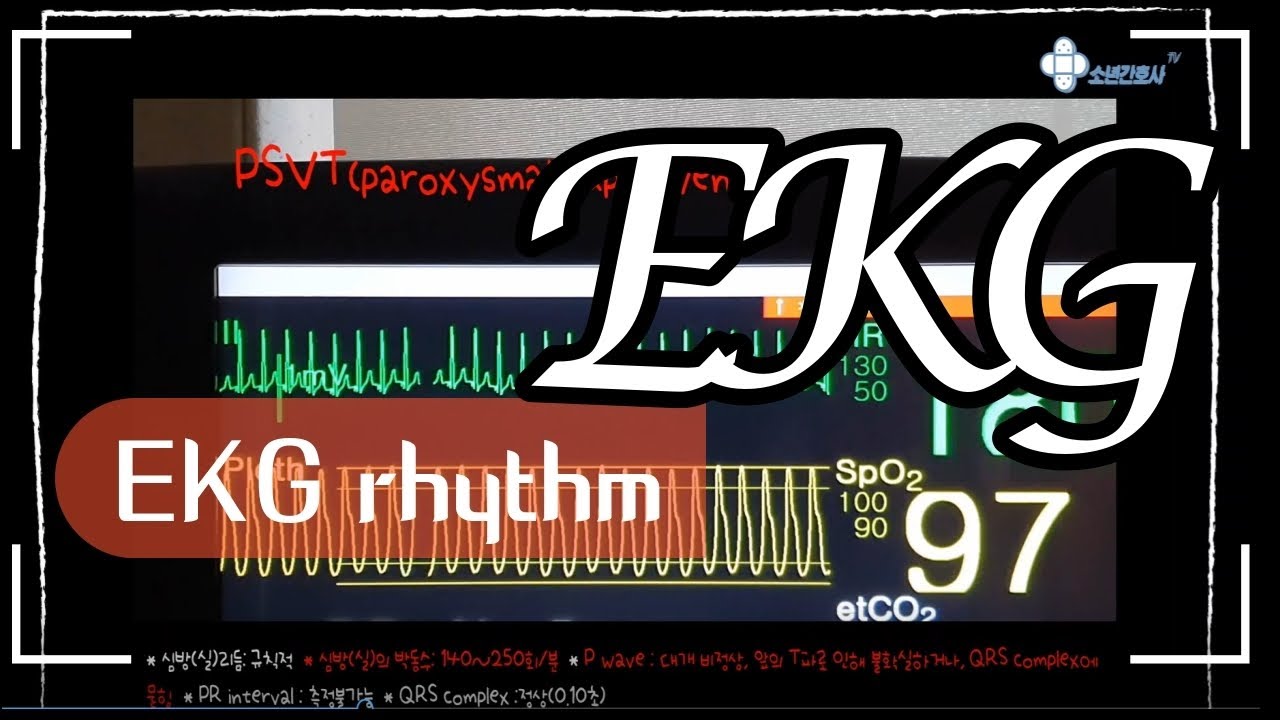 EKG rhythm, 중환자실 간호사는 모니터만 보고 분간해내야죠?! 이 영상이면 충분합니다.
