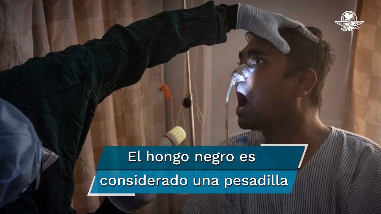 Esto es lo que sabemos sobre la rara infección por hongos que ataca a pacientes con Covid en India