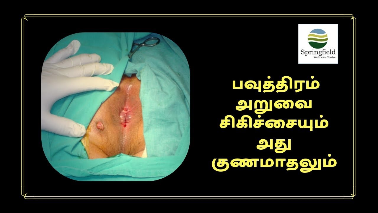 பவுத்திரம் அறுவை சிகிச்சை செய்து கொண்ட பின்னர் எத்தனை நாட்களில் உடல் நலம் அடையும்? Fistula Surgery