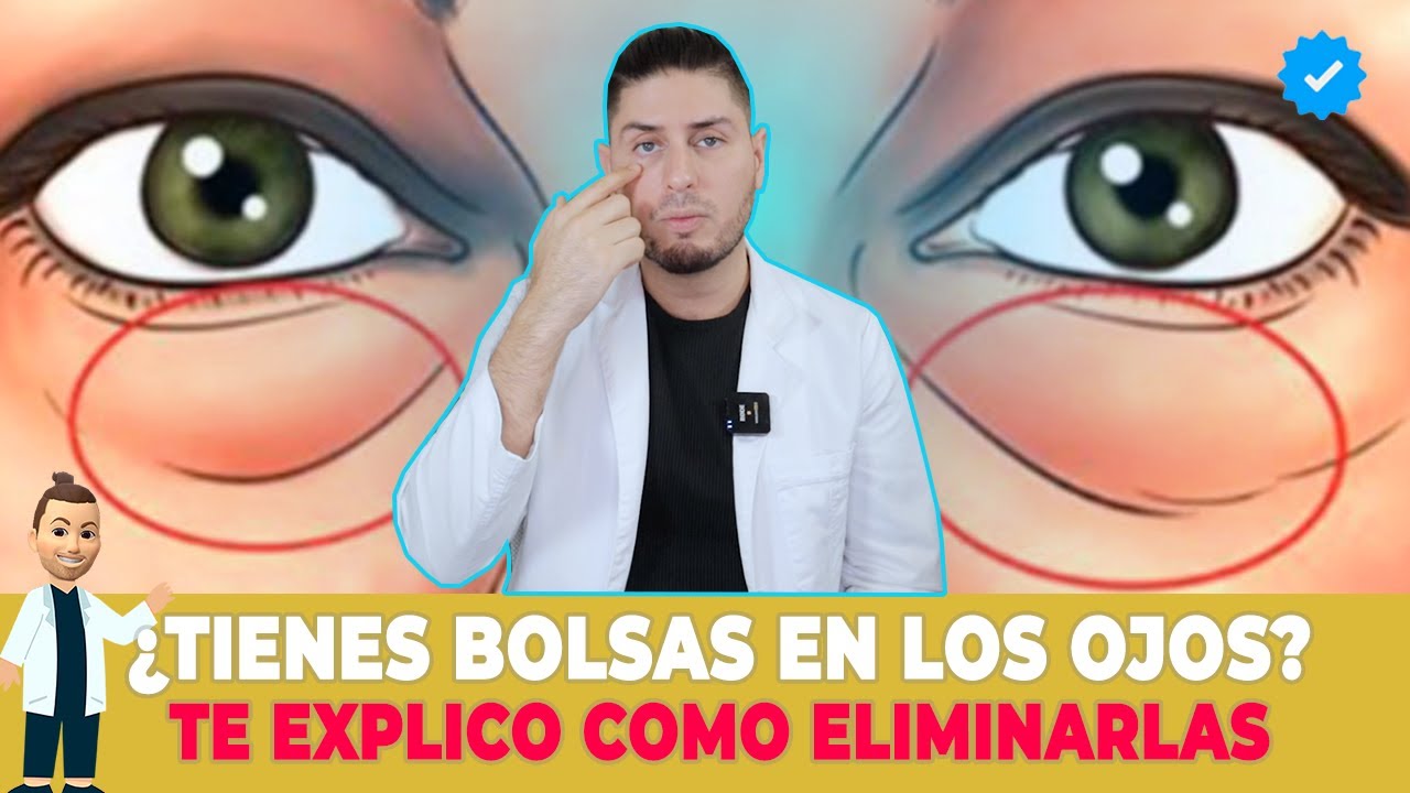Bolsas en los ojos ¿Qué hacer y cómo prevenirlos? 🐼| DOCTOR LEMUS