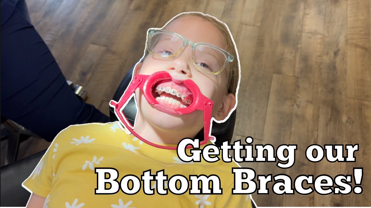 Tiger Gets Her Bottom Braces! Orthodontist Visit Step-By-Step | Wilder Family Vlog