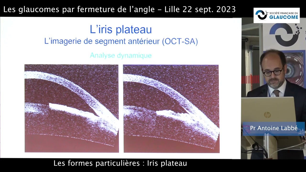 Iris plateau Pr Antoine Labbé