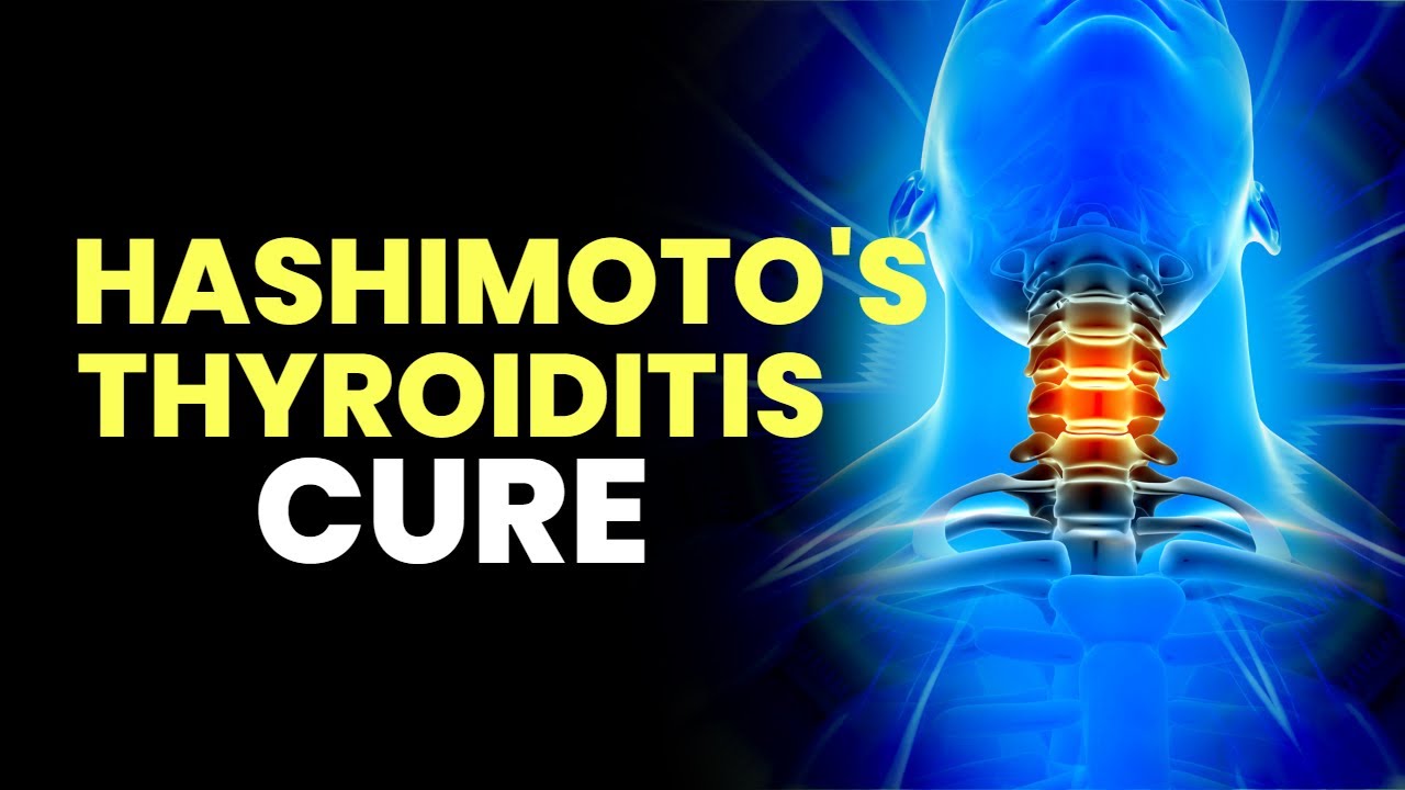 Hashimoto's Thyroiditis Cure | Heal Hypothyroidism | Get Rid Of Autoimmune Disorders | Binaural Beat