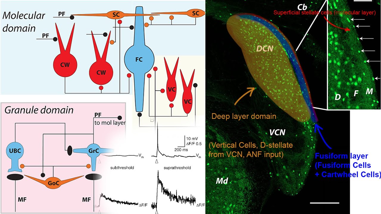 Bisensory Neuromodulation For Tinnitus. Subthreshold EPSPs, Auditory & Somatosensory Brainstem 