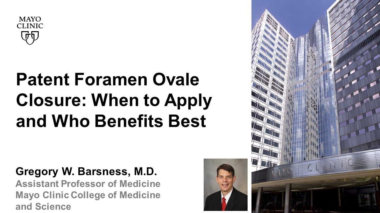 Patent Foramen Ovale Closure When to Apply and Who Benefits Best